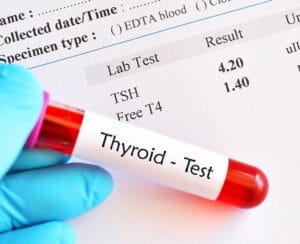 thyroid function test