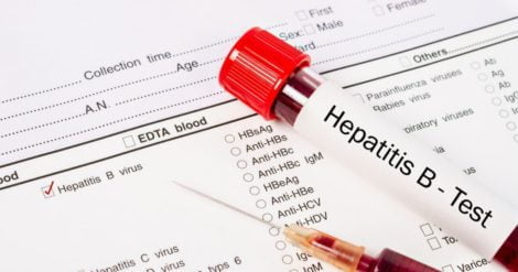 Hepatitis-B Virus test