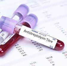 Antistreptolysin Titre test(ASOT)