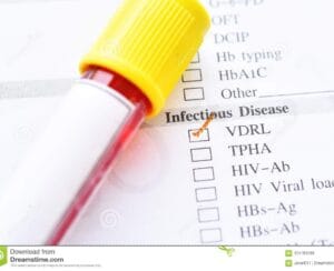 VDRL Blood test