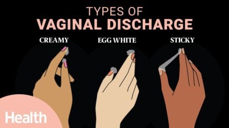 Vaginal secretion